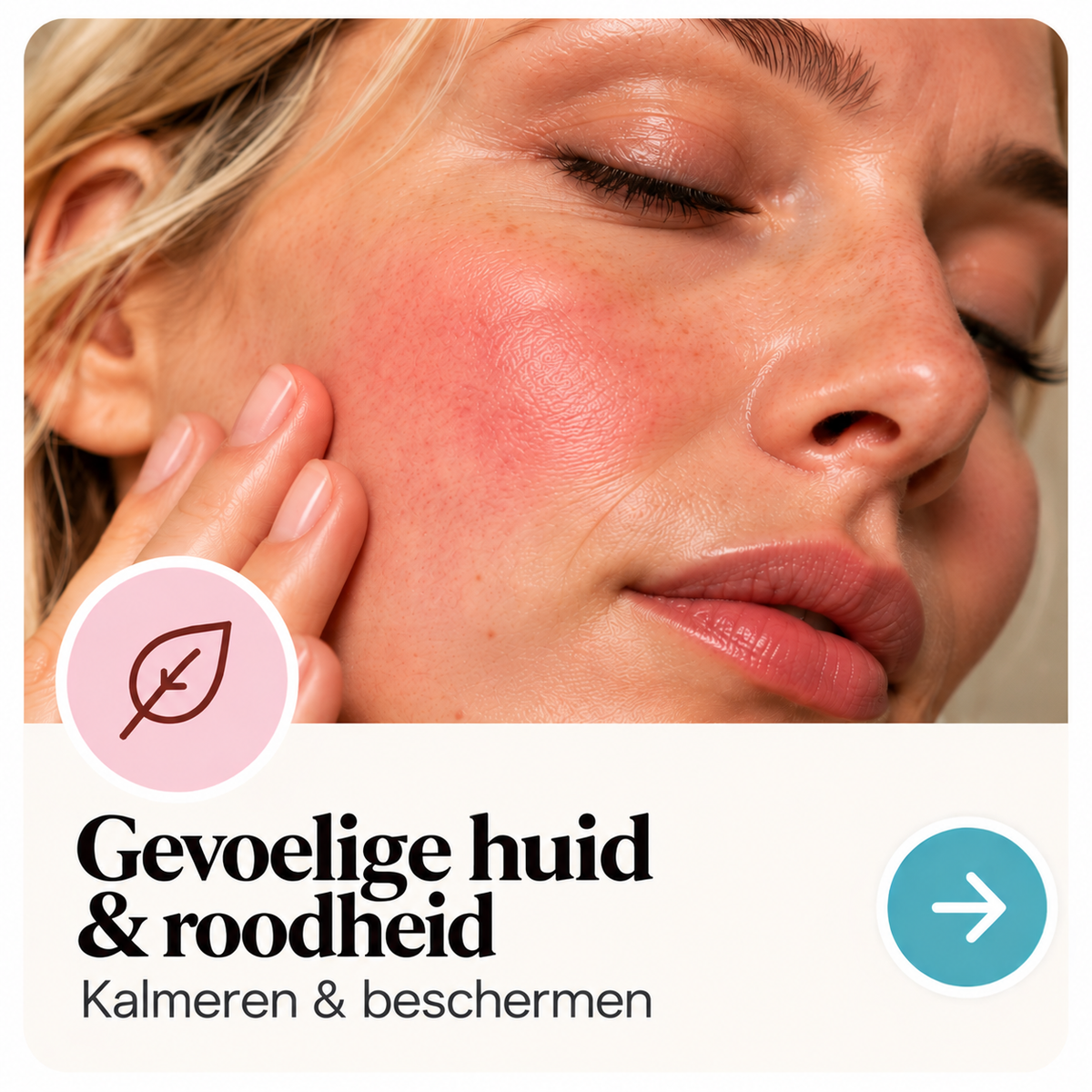 Gevoelige huid